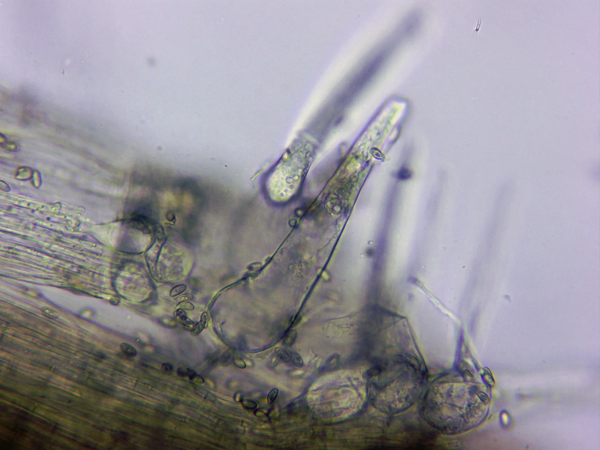 Microscopía de Macrocystidia cucumis - 10 - Caulocistidios agua x 400